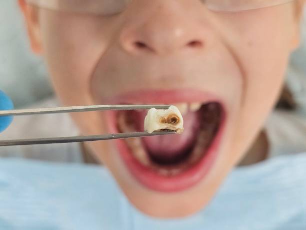 Best Emergency Dentist for Kids  in Miami, OK